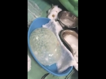 Həkimlərimiz 7 yaşlı qızı xilas etdilər Həkimlərimiz 7 yaşlı qızı xilas etdilər